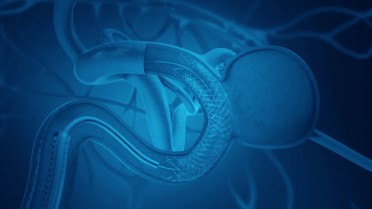 FRED™ — official product image (Terumo Neuro)